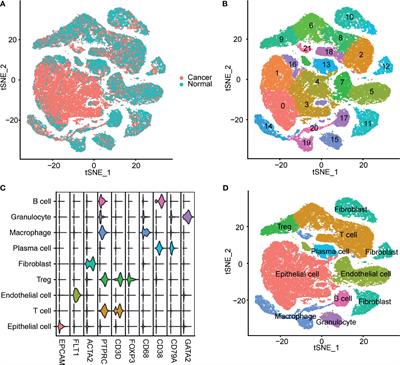 Integrative Analysis Identified MCT4 as an Independent Prognostic Factor for Bladder Cancer